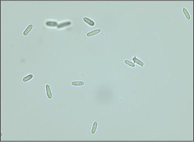 Colletotrichum spores
